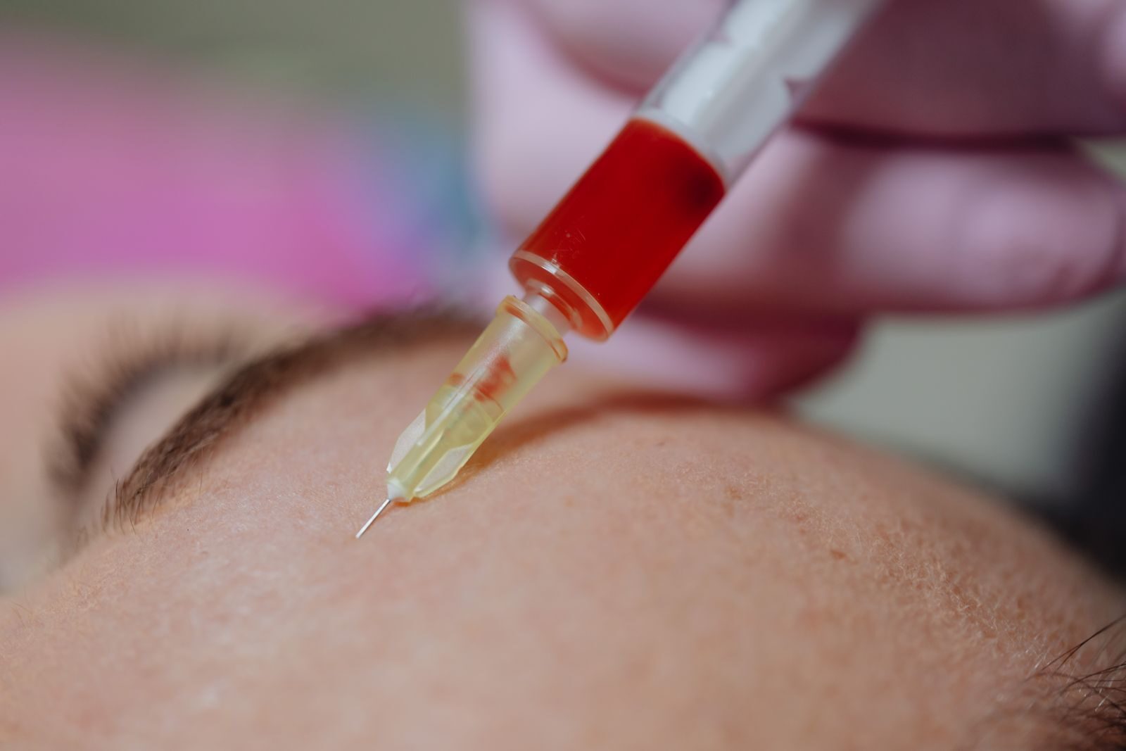 A detailed view of a syringe injection in a clinical setting.