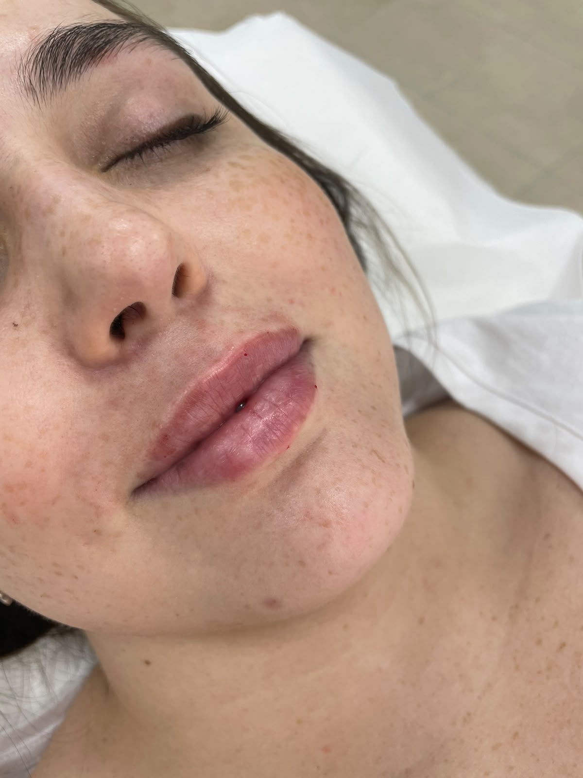 labios